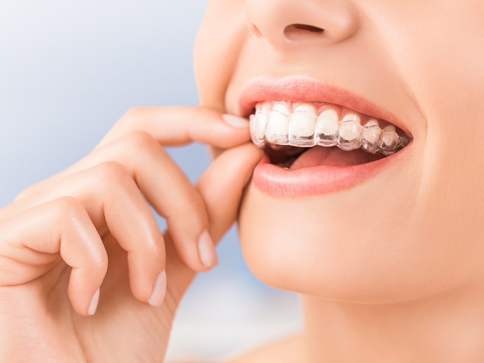 How long does an Invisalign treatment take?