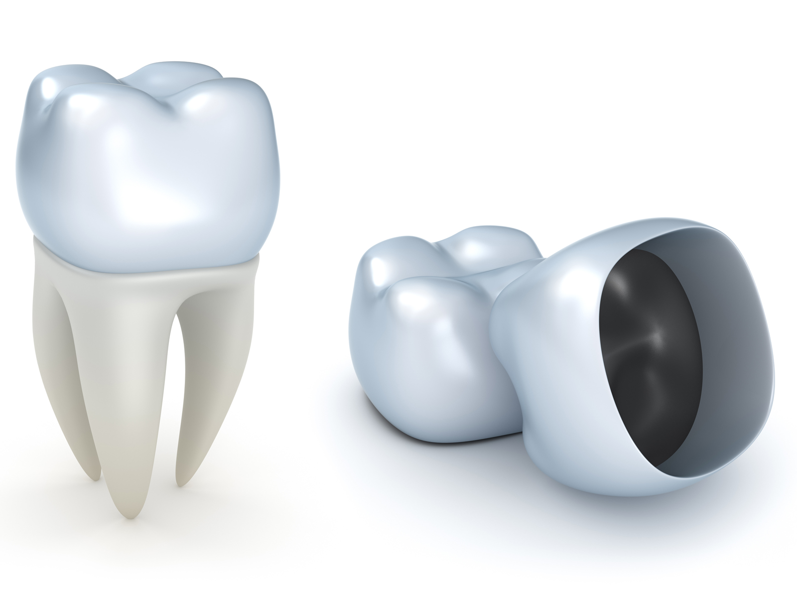 Who is a good candidate for dental crowns?
