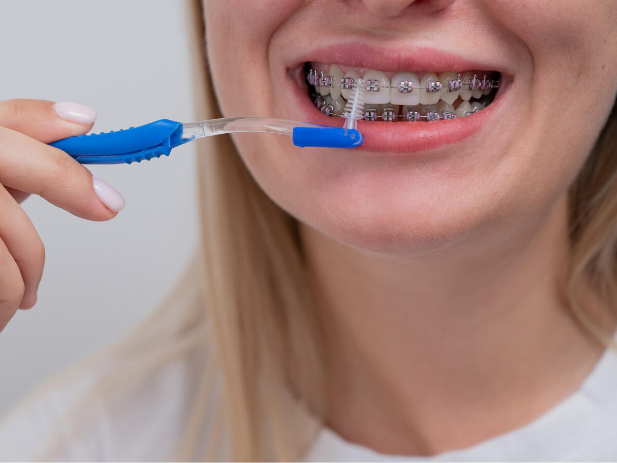 Electric Toothbrush With Braces