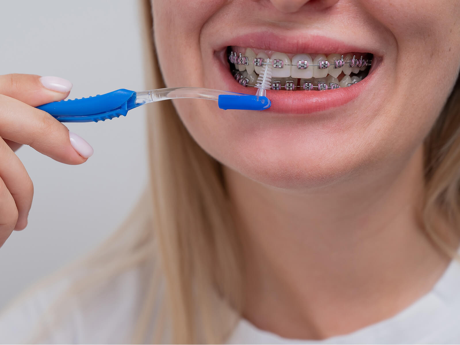 Can You Use An Electric Toothbrush With Braces?