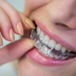 5 Signs It's Time to Replace Your Teeth Grinding Guard