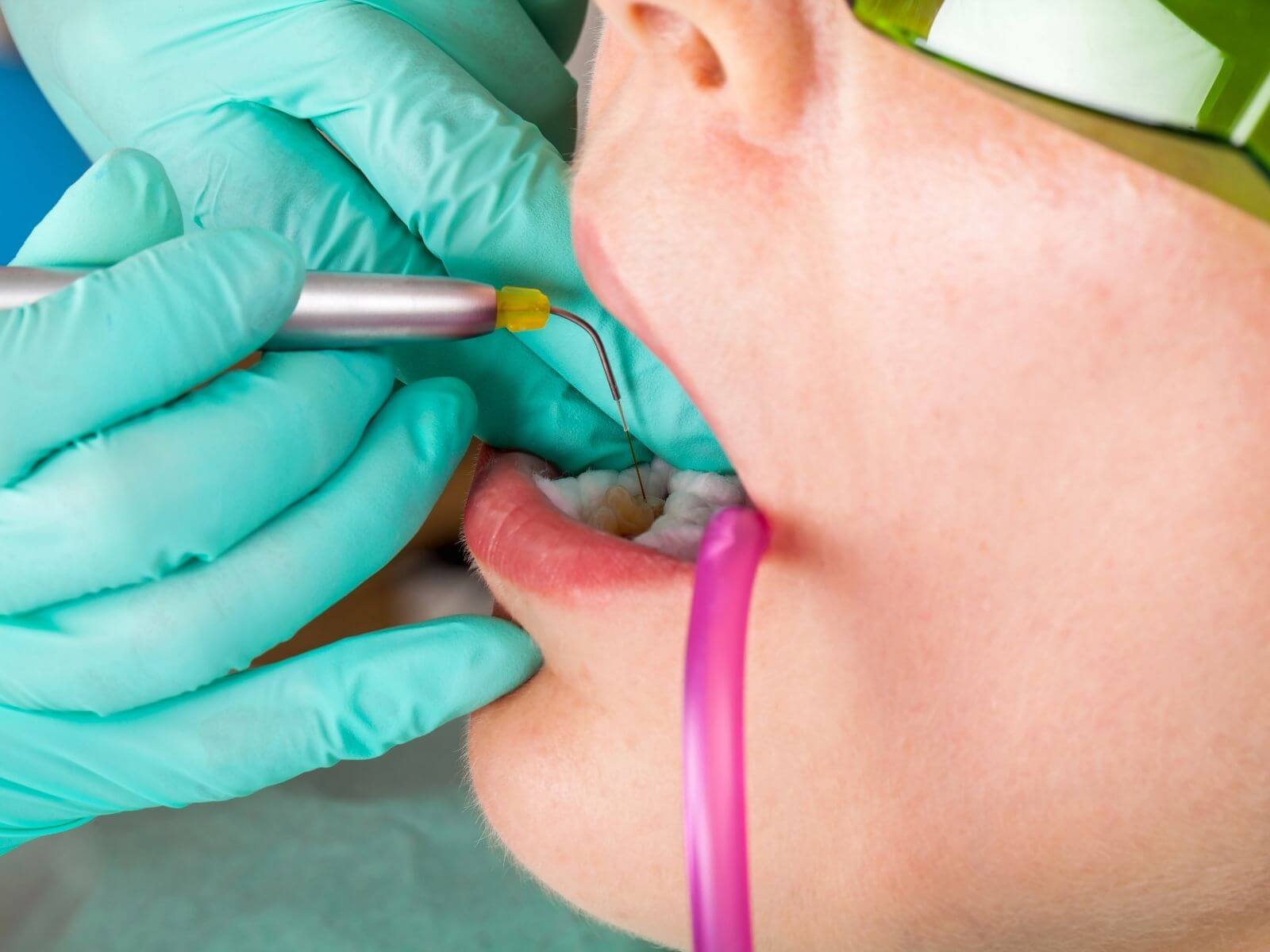 Gum Disease: How Laser Therapy Can Help